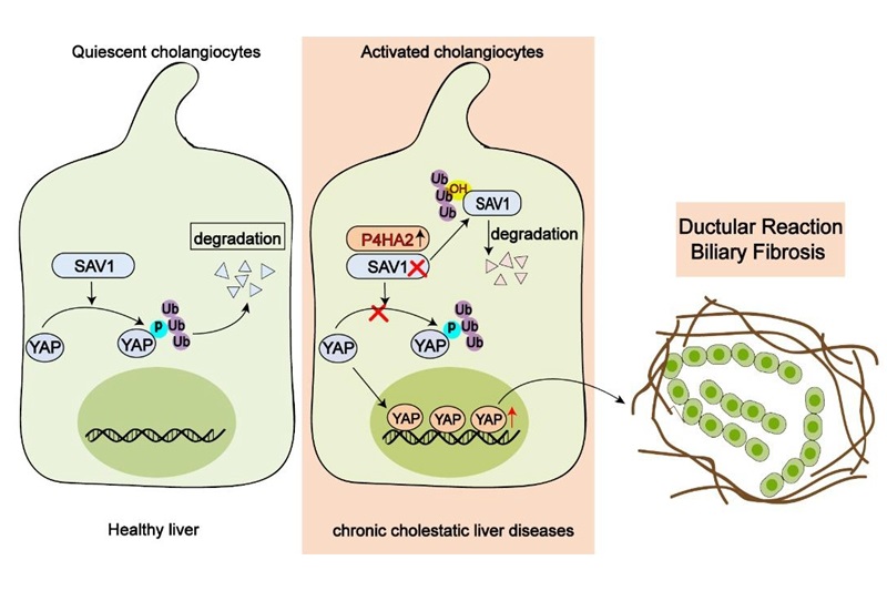 探索胆汁淤积性肝纤维化新型治疗靶点，附属仁济医院马雄教授团队发表最新研究结果